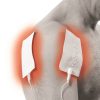 frozen shoulder